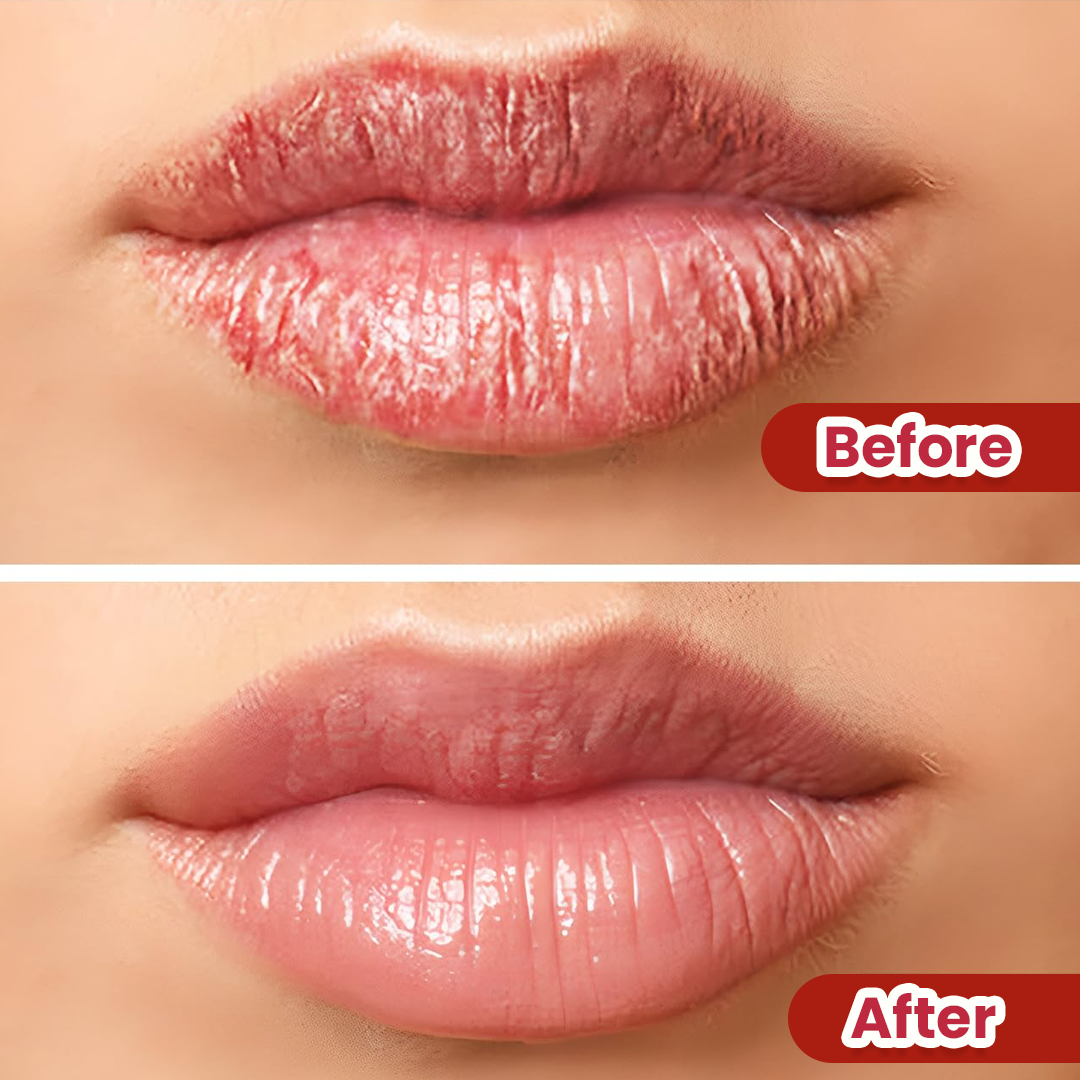 LIP BALM